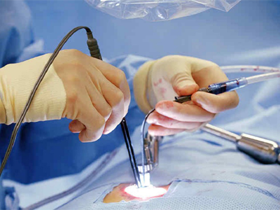 Endoscopic Spine SUrgery